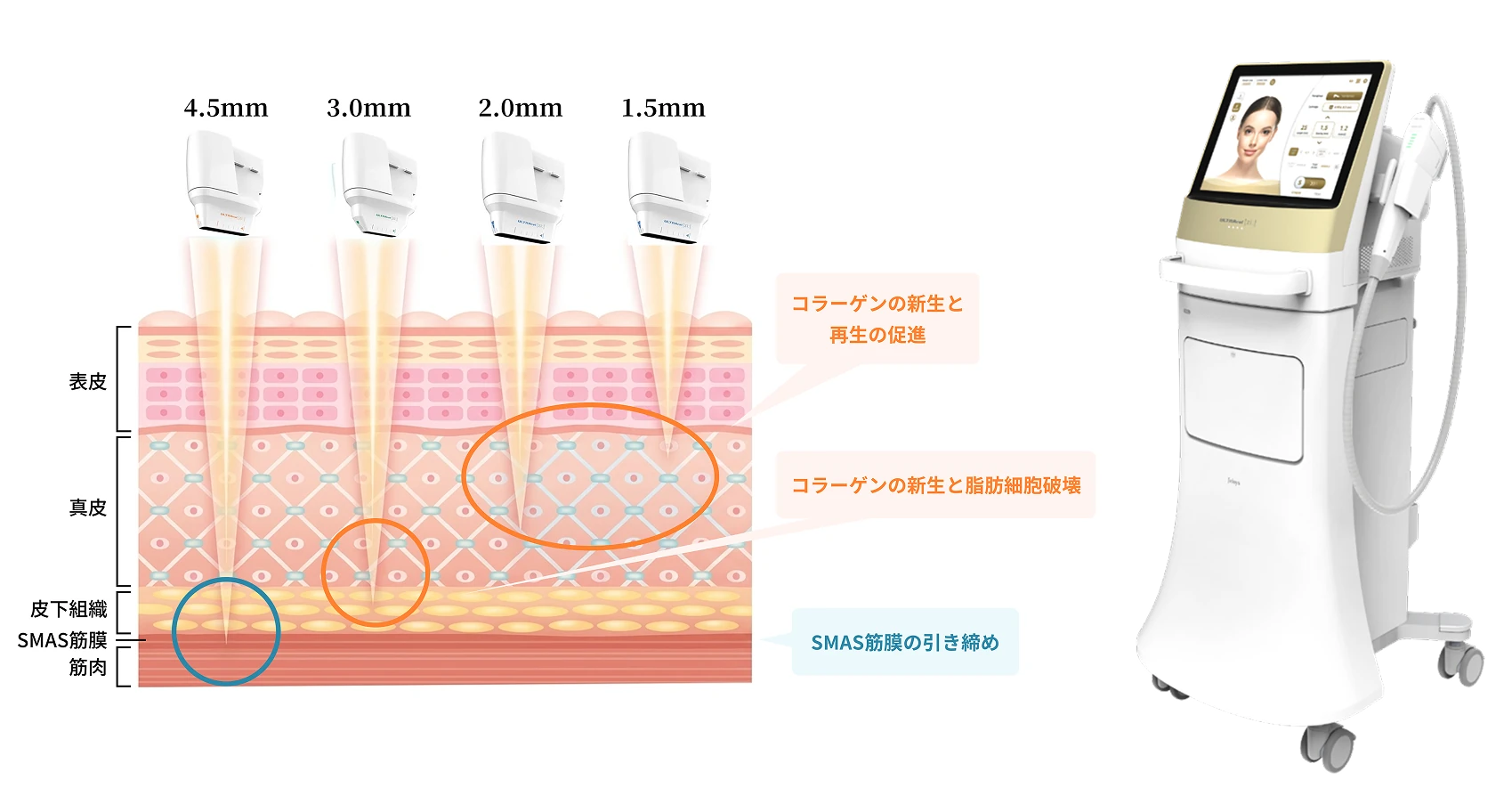 深さ別（4.5mm／3.0mm／2.0mm／1.5mm）の照射イメージとULTRAcel本体。各層への作用：コラーゲンの新生と再生の促進、コラーゲンの新生と脂肪細胞破壊、SMAS筋膜の引き締め。