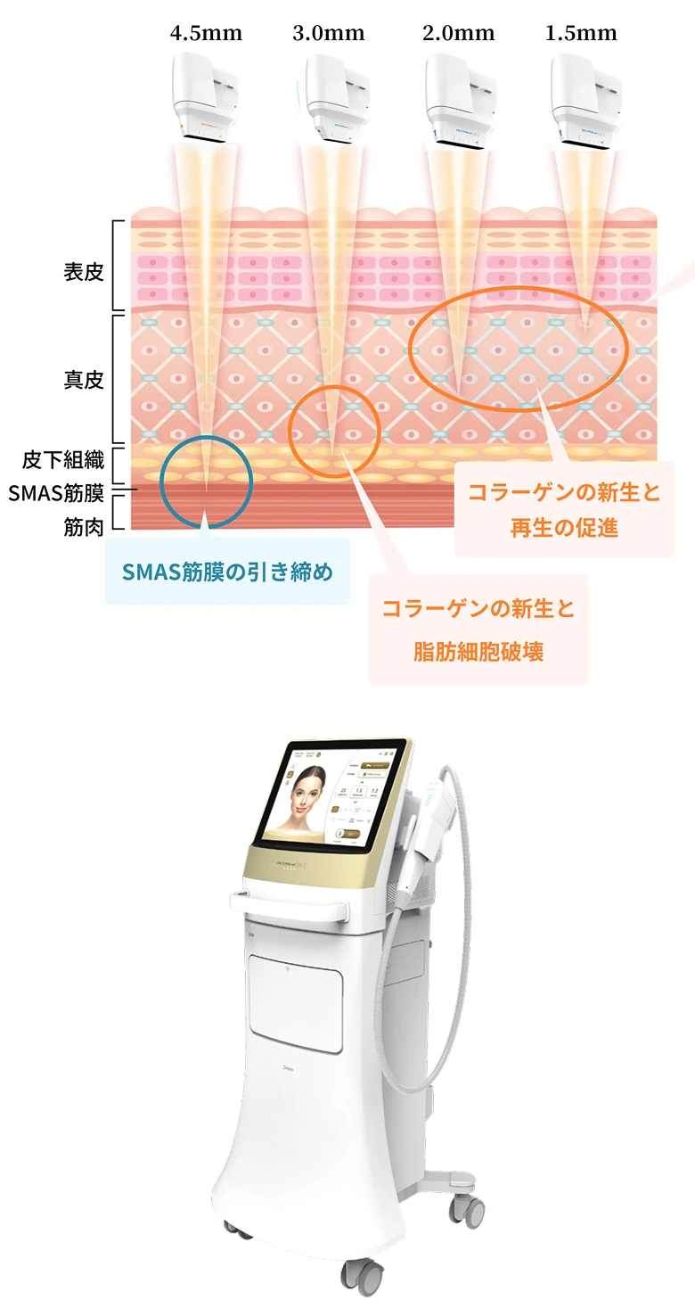 深さ別の照射イメージとULTRAcel本体
